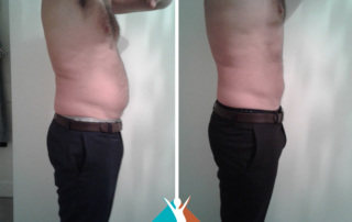 fat reduction in Addiscombe