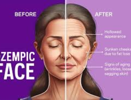 The “Ozempic Face” Effect